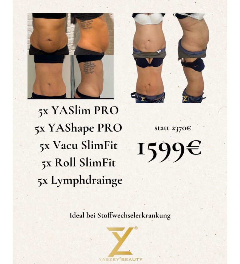 Bodyforming-Paket 4 – Stoffwechsel-Kombi (5x YASlim Pro, YAShape Pro, Vacu SlimFit, Roll SlimFit, Lymphdrainage)